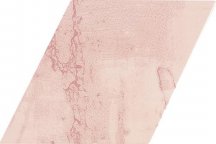 Ape Snap Rombo Pink 15x25.9